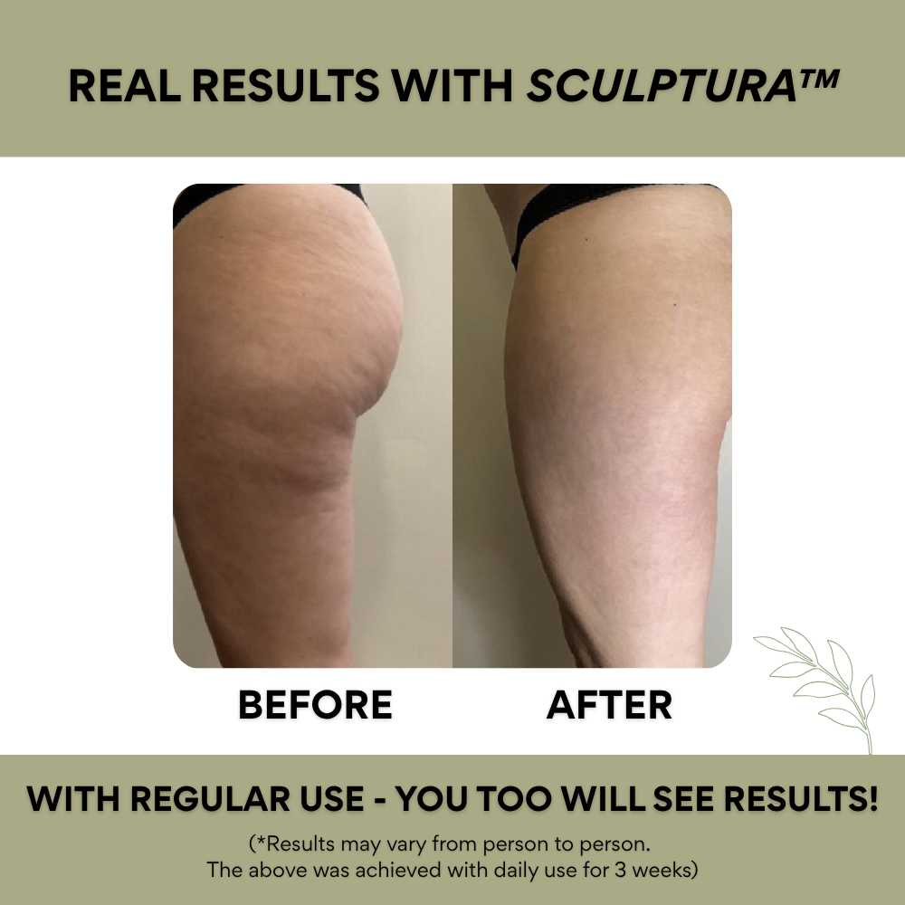 Sculptura™