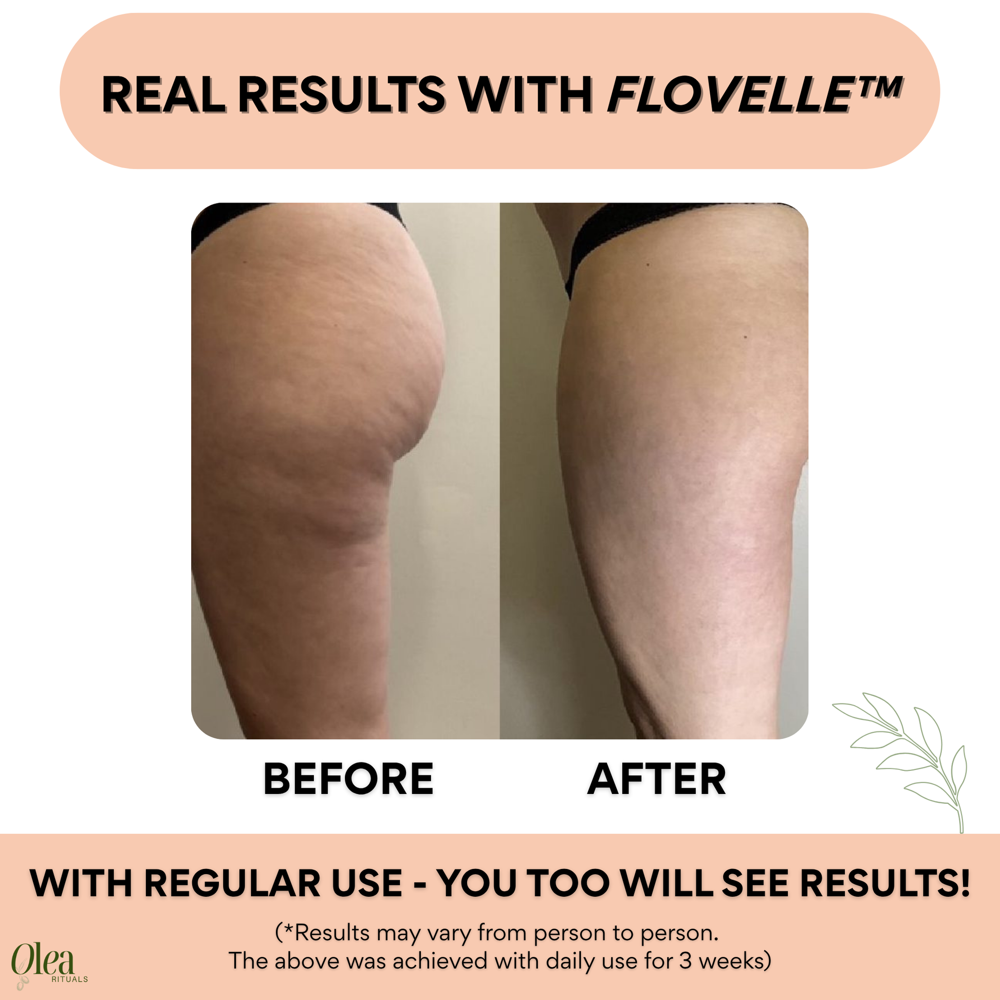 Flovelle™ Lymphatic Body Roller