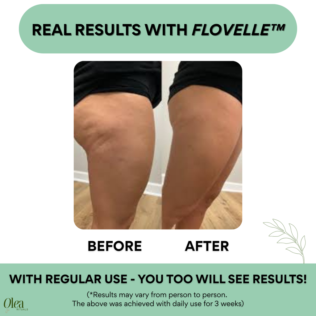 Flovelle™ Lymphatic Body Roller